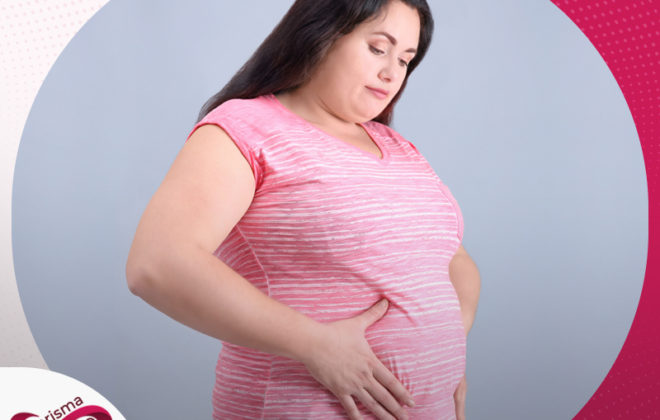 عملية شفط الدهون بالفيزر