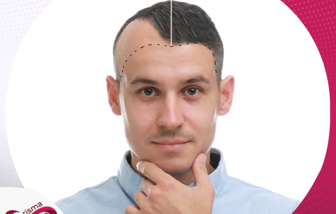 عيادات مصر التخصصية لزراعة الشعر